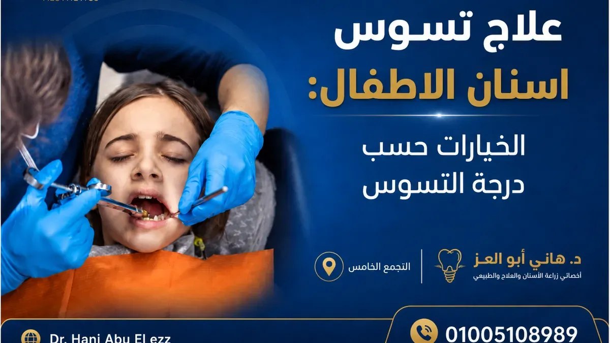 علاج تسوس أسنان الأطفال: الخيارات حسب درجة التسوس