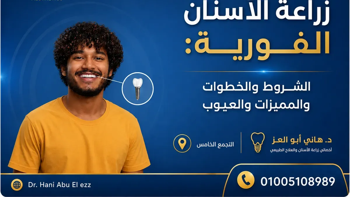 زراعة الأسنان الفورية: الشروط والخطوات والمميزات والعيوب