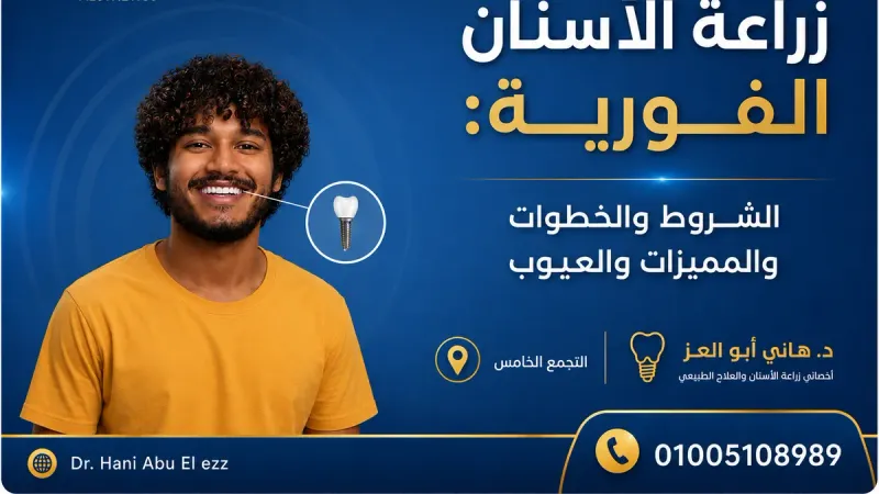 زراعة الأسنان الفورية: الشروط والخطوات والمميزات والعيوب